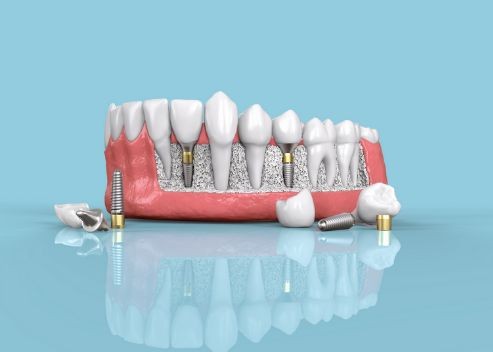 DANTHIKA MULTI SPECIALITY DENTAL CARE KONDOTTY